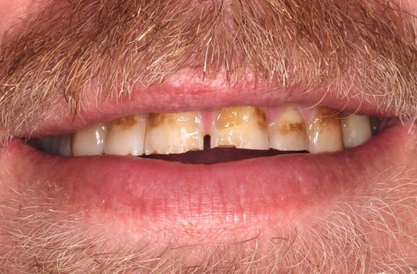 Before - Halo Dental