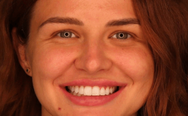 After -Halo Dental