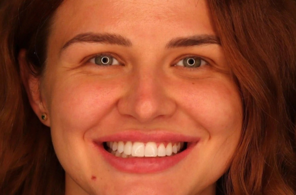 After -Halo Dental