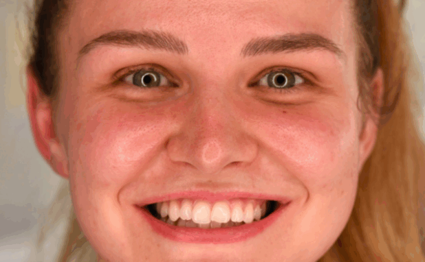 Before - Halo Dental