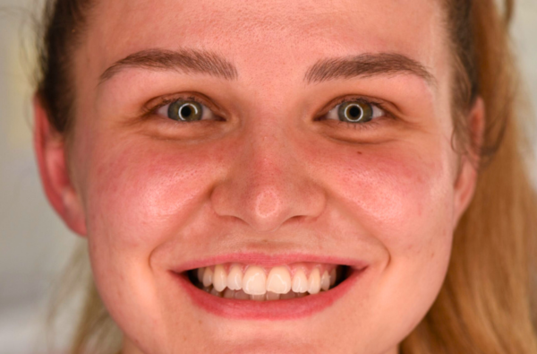 Before - Halo Dental