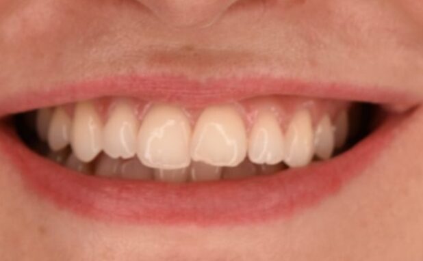 Before - Halo Dental