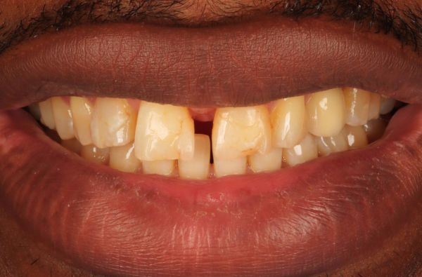 Before - Halo Dental
