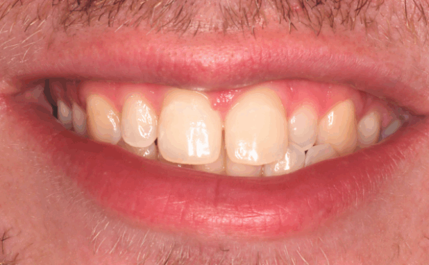 Before - Halo Dental