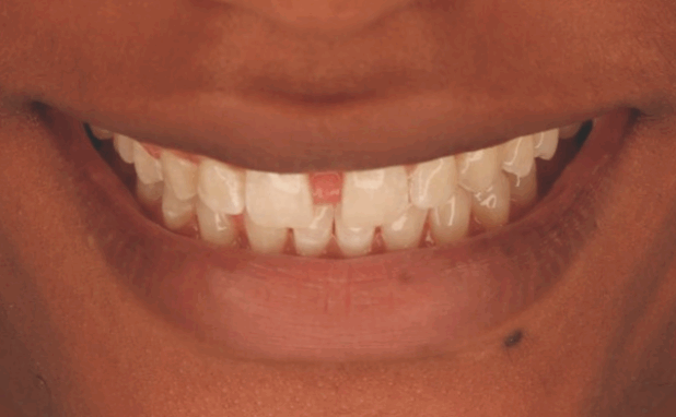 Before - Halo Dental