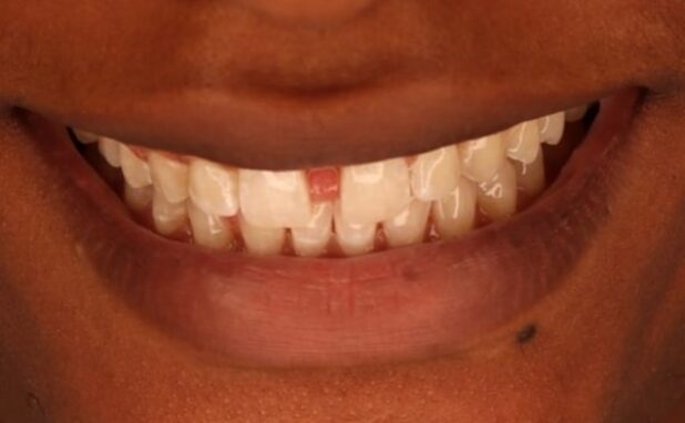 Before - Halo Dental