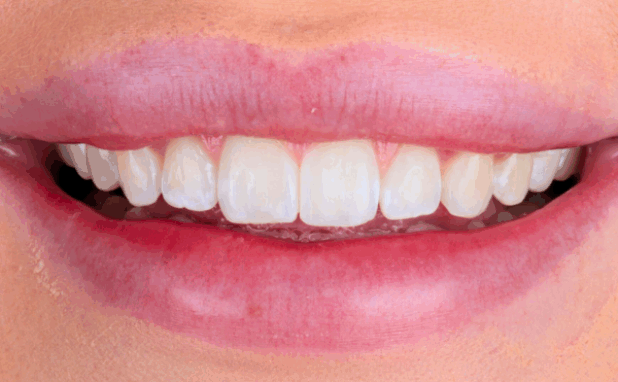 After -Halo Dental