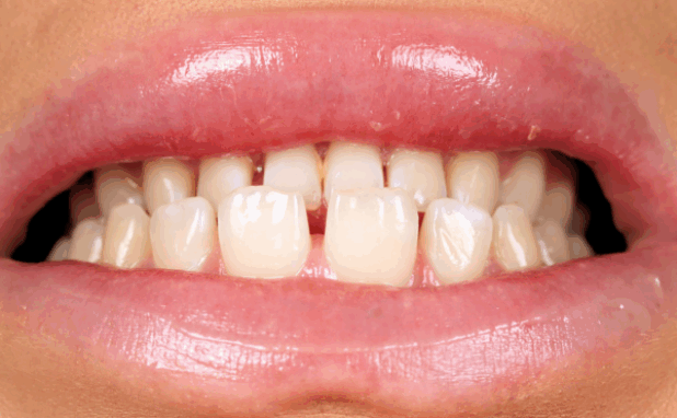 Before - Halo Dental