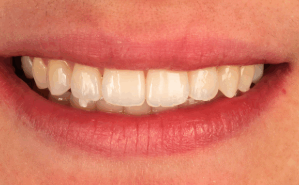 After -Halo Dental