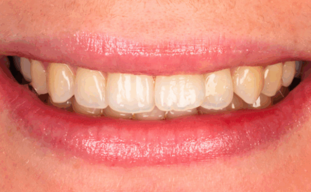 Before - Halo Dental