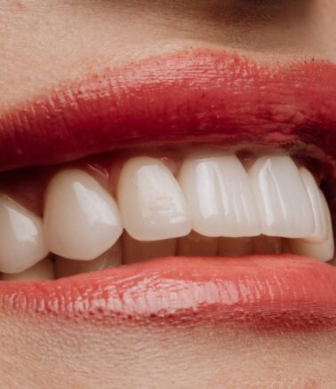 Treatment -  Halo Dental