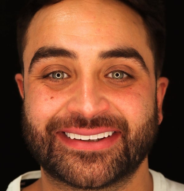 After Face -Halo Dental